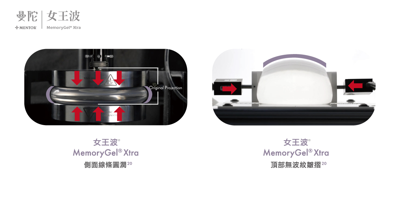 女王波Mentor MemoryGel® Xtra-曼陀女王波工藝解析  AI精準填充