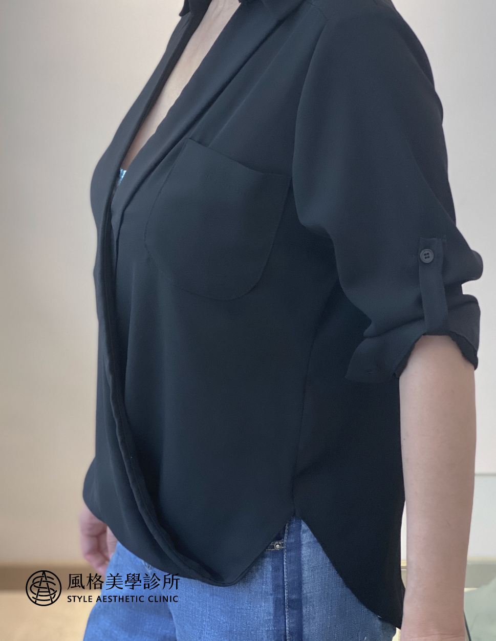 魔滴隆乳案例,Motiva魔滴隆乳案例(凍齡姐姐)