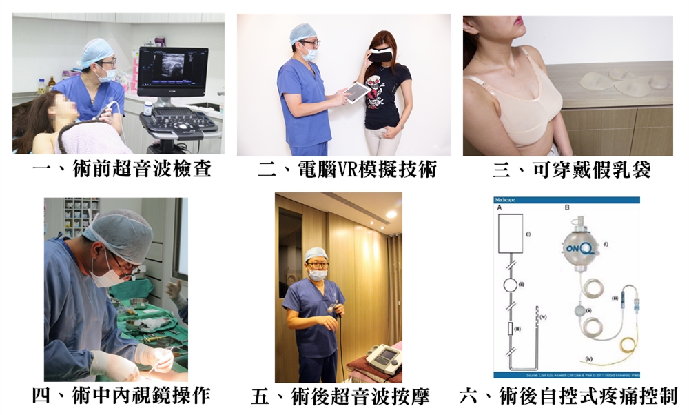 台中隆乳,台中隆乳推薦,詹本立院長,風格美學