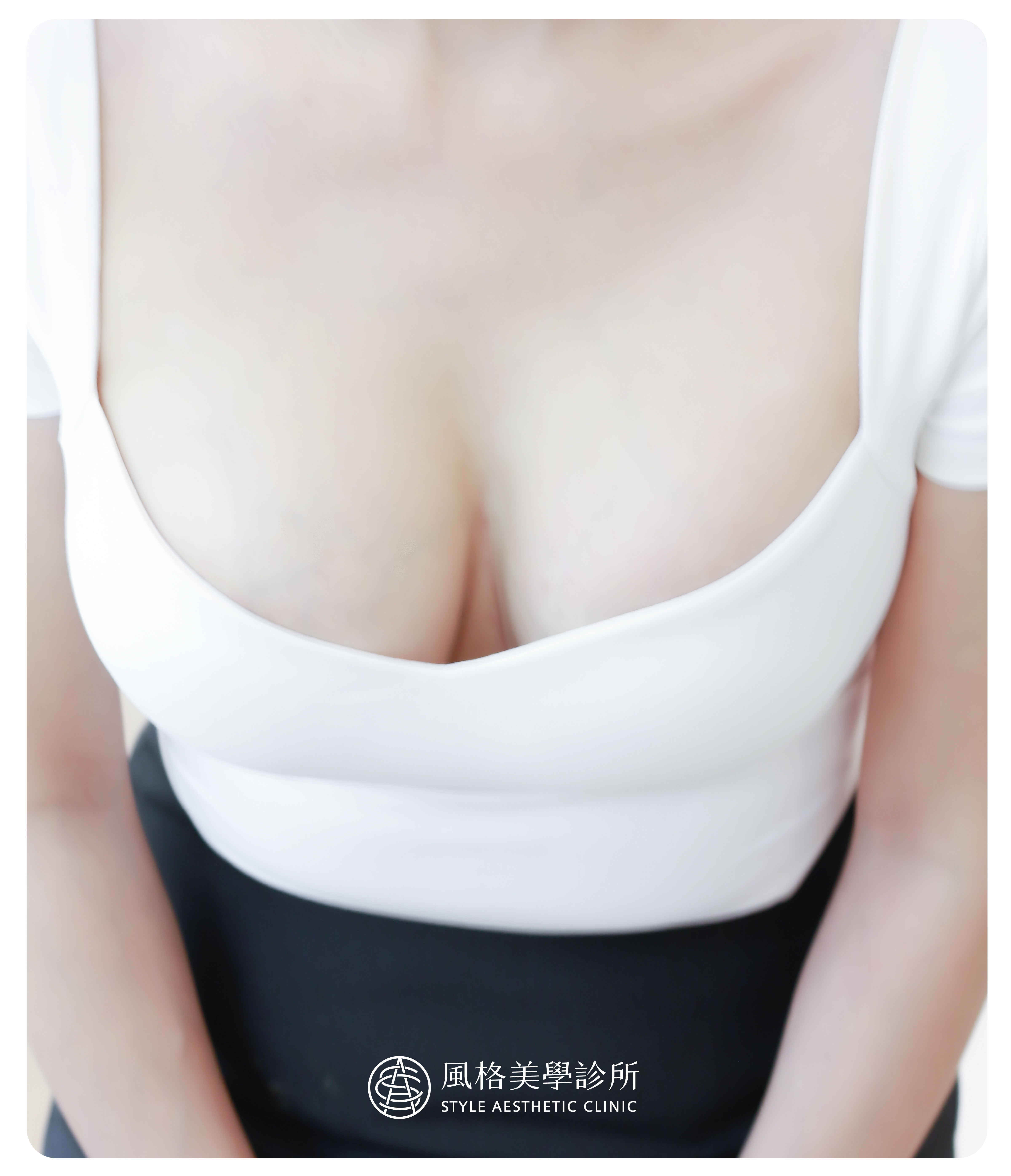 【台中MOTIVA隆乳】我要做個偉大又自信的漂亮媽媽！