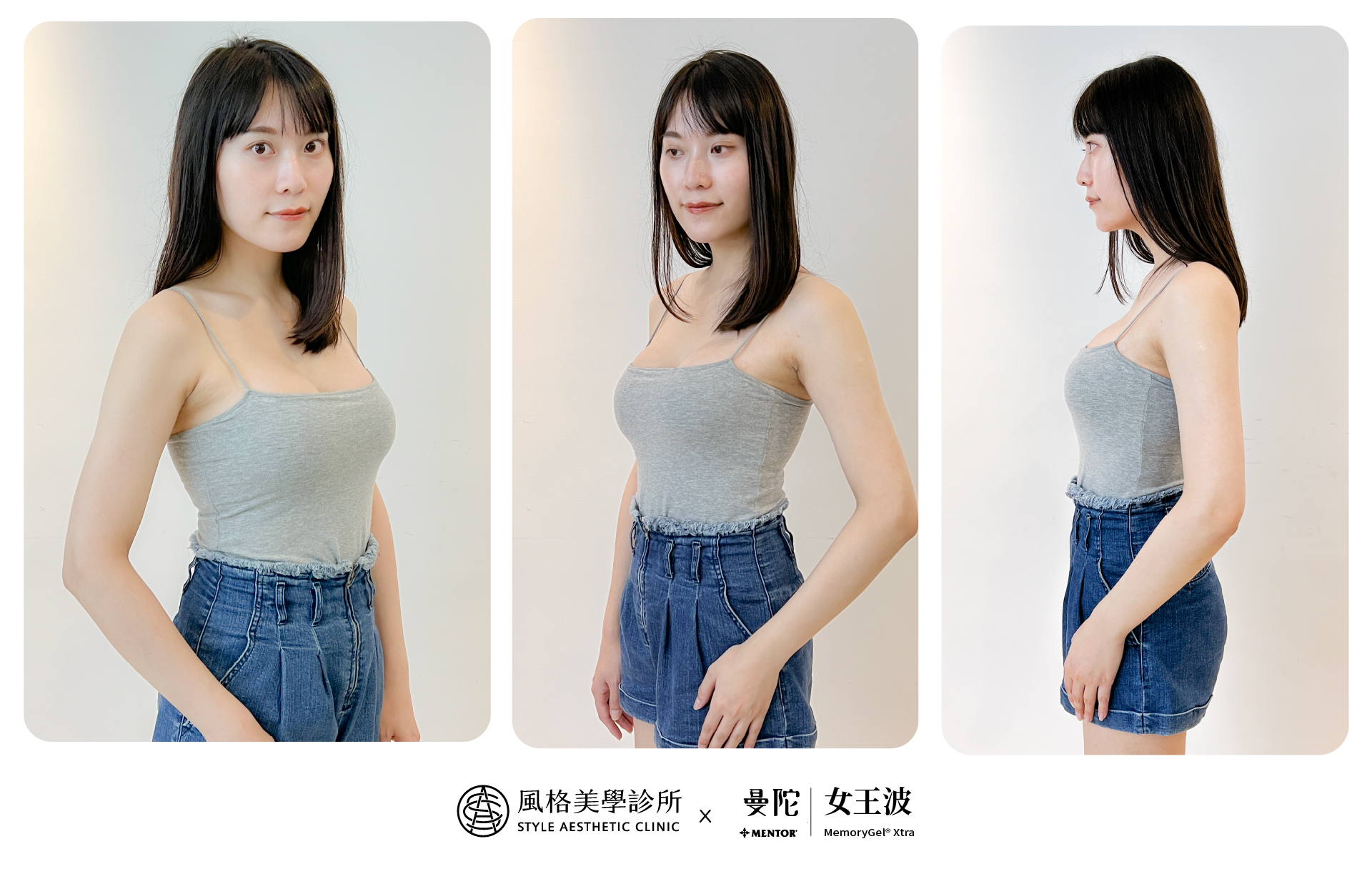 女王波,女王波隆乳,女王波隆乳案例