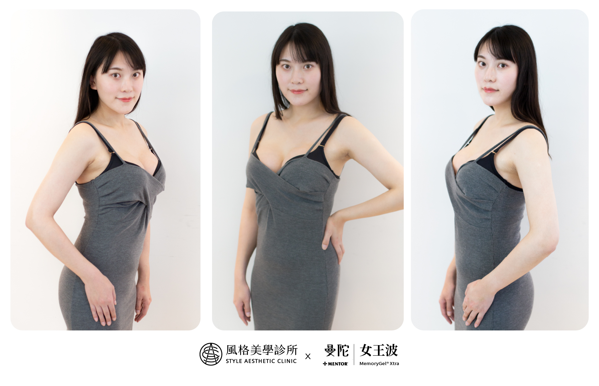 女王波,女王波隆乳,女王波隆乳案例 【女王波隆乳】從小A升級到D 把自信變得具體
