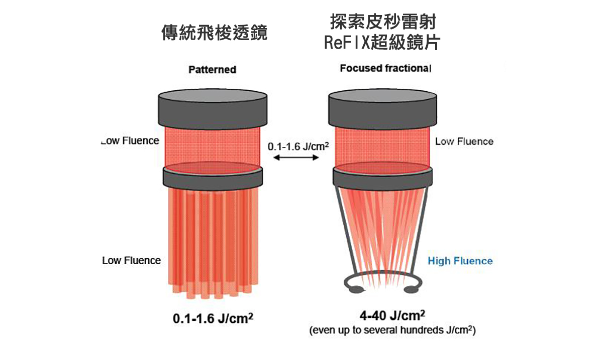 新一代皮秒雷射科技，針對色素斑、肌膚老化問題與刺青