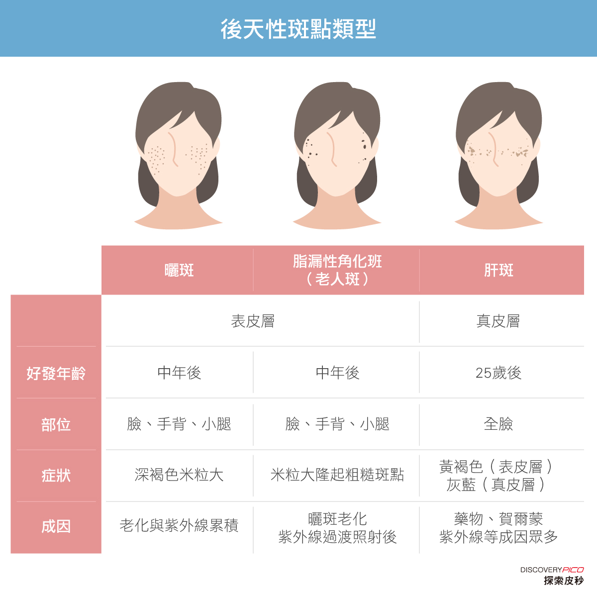 皮秒雷射-後天性斑點類型